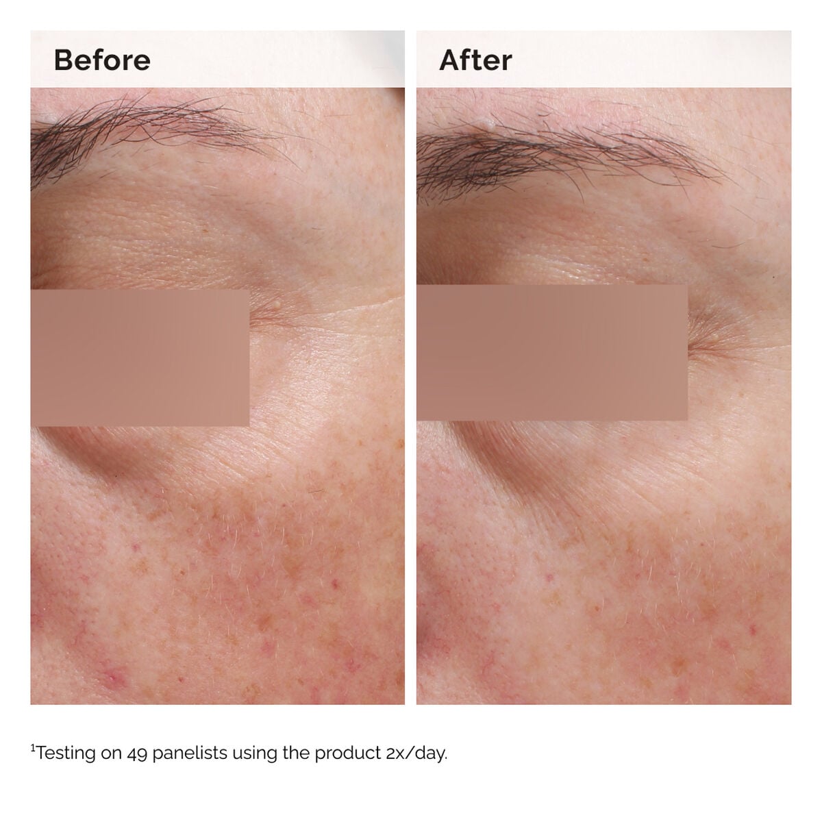 niacinamide-5-face-and-body-emulsion-x8 2024-08-23-ORD-Nia-5pct-Face-Body-B-A-Elasticity-Global-02-1x1.jpg
