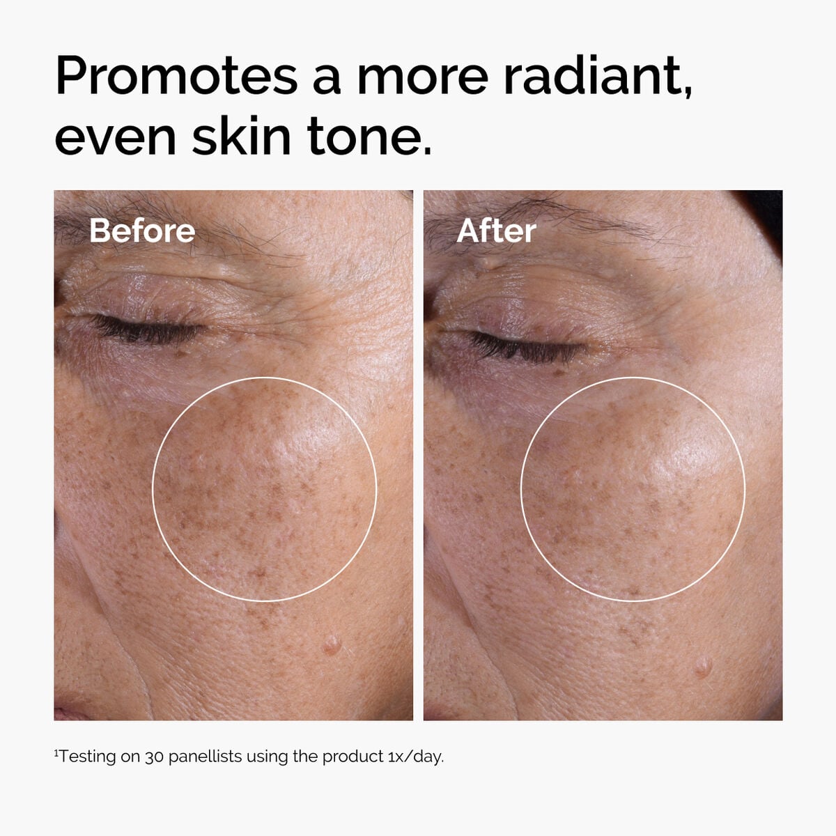 glycolic-acid-7-exfoliating-toner-f0 ord-glycolic-before-after-radiance.jpg