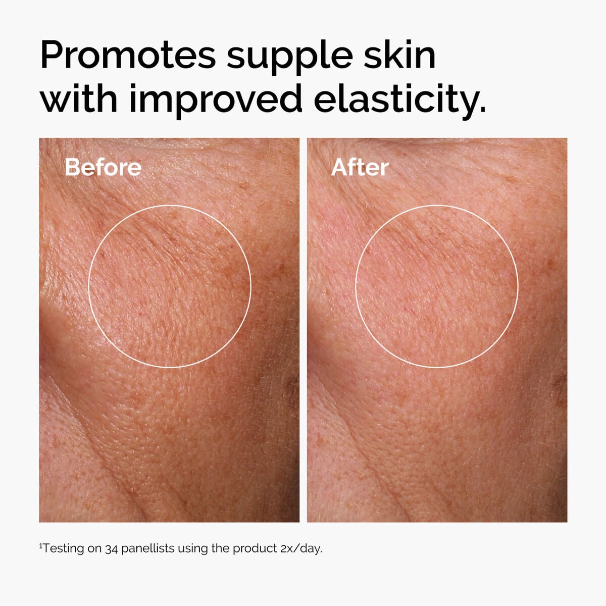 hyaluronic-acid-2-b5-with-ceramides-t2 ord-hyaluronic-acid-2pct-b5-hydrating-serum-before-after-elasticity.jpg