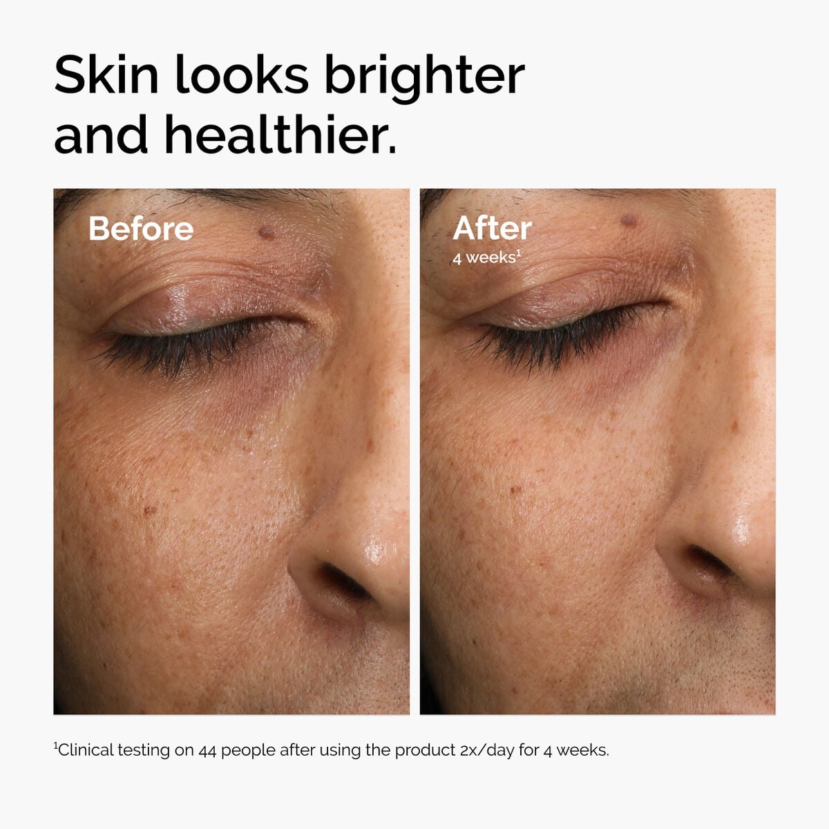 multi-antioxidant-radiance-serum-h8 ord-mars-before-after-healthy.jpg