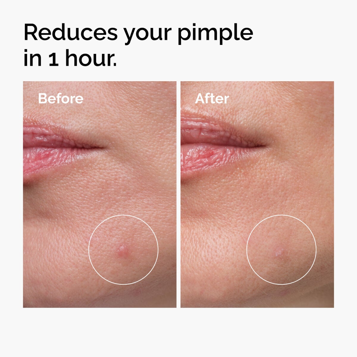 sulfur-10-powder-to-cream-concentrate-y6 ord-sulfur-10pct-powder-to-cream-concentrate-before-after-NA.jpg